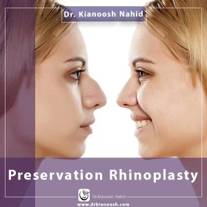 Preservation Rhinoplasty